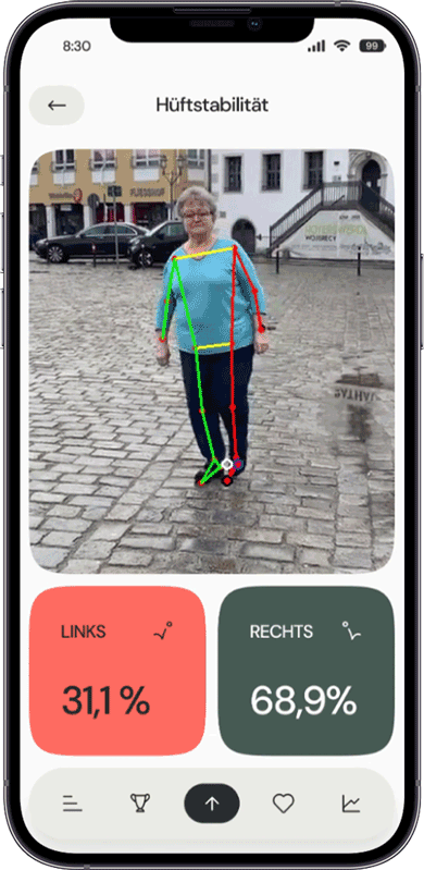 Gait Analysis Mockup 3